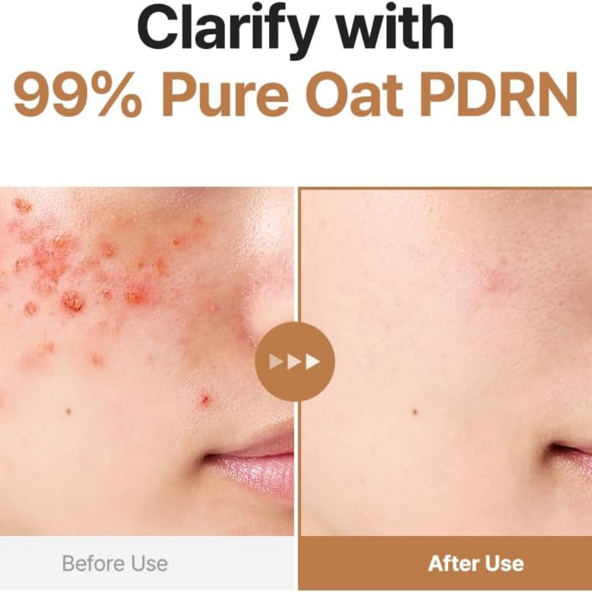 Purito Seoul - Oat PDRN Gentle Refining Toner 200 ml - Billede 3