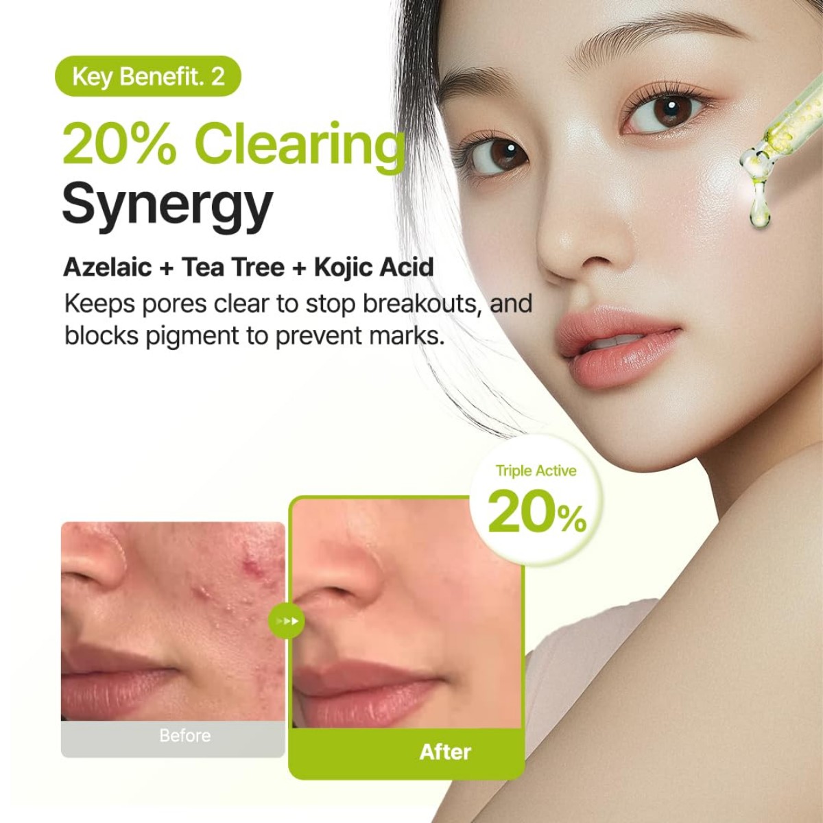 Purito Seoul - Azelaic Acid 10 Kojic Tea Tree Serum 30 ml - Billede 5