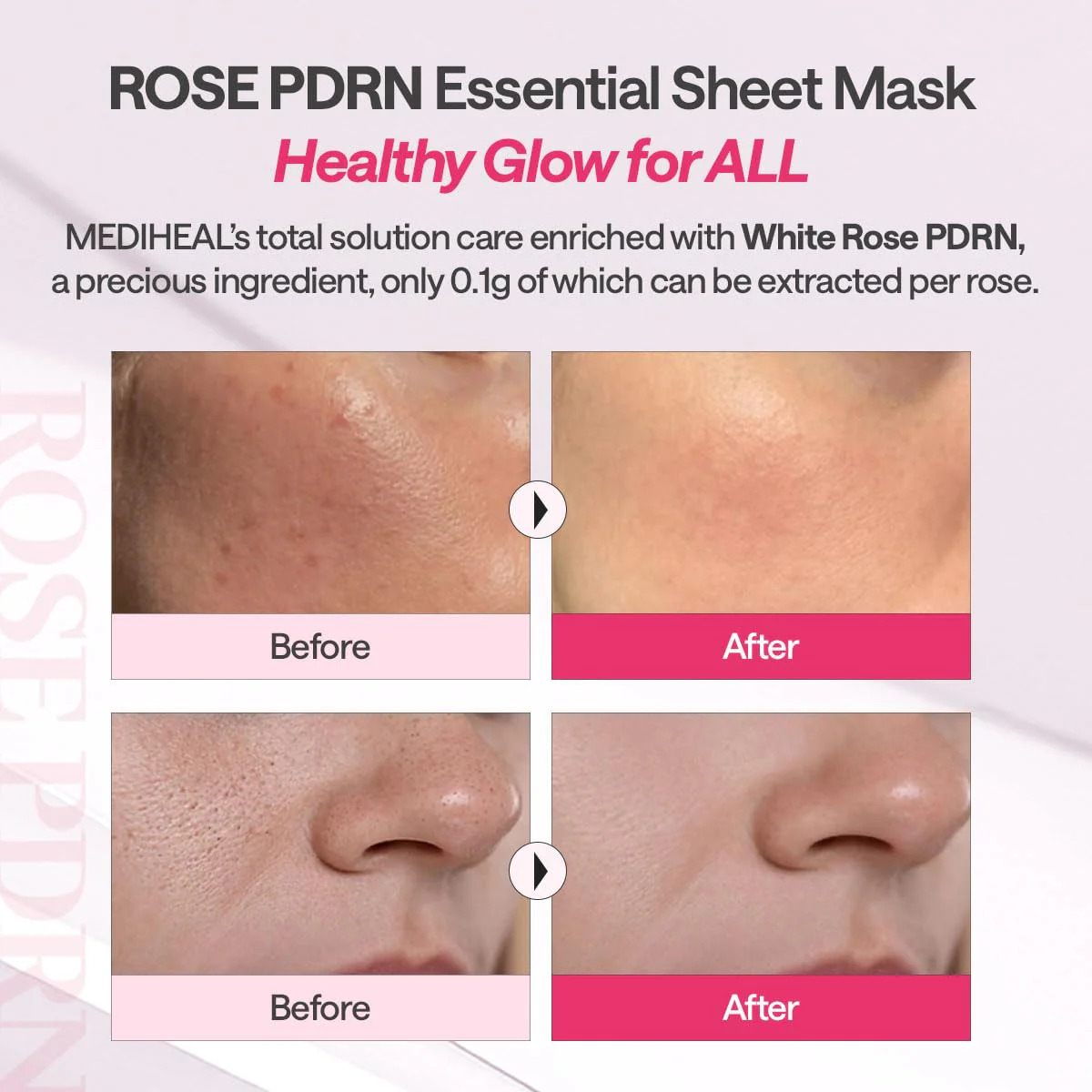 Mediheal - Rose Pdrn Essential Mask Healthy Glow - Billede 2