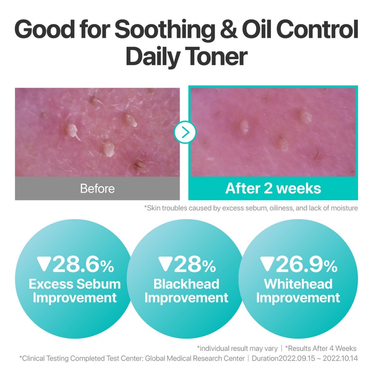 Numbuzin - No.1 Pure-Full Calming Herb Toner 300 ml - Billede 4